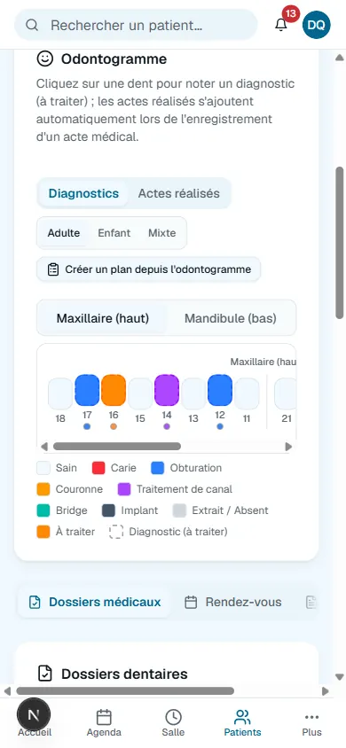 L’odontogramme sur un téléphone&nbsp;: les dents du maxillaire colorées par diagnostic, la légende des états et les onglets Diagnostics et Actes réalisés.